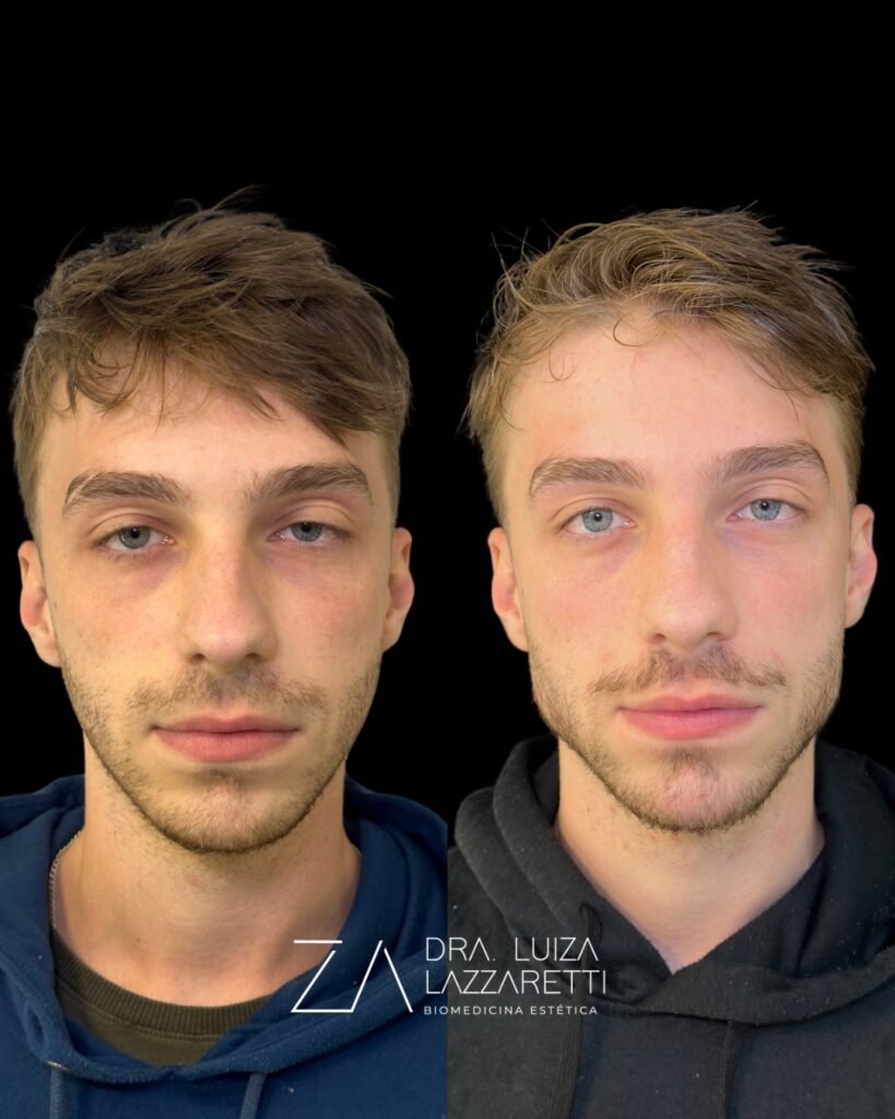 Mandibula E mento - DraLuizaLazzaretti